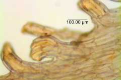 Cuscuta montana, scales' fimbriae