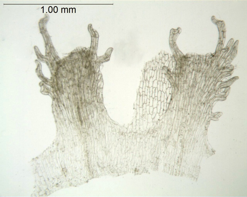 Cuscuta coryli; U.S.A, Arkansas, Demaree 19603 (CAS)
