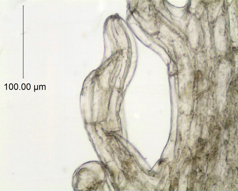 Cuscuta coryli; U.S.A, Arkansas, Demaree 19603 (CAS)