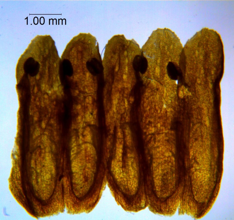 Cuscuta parodiana; Argentina, Novara 7976 (S)