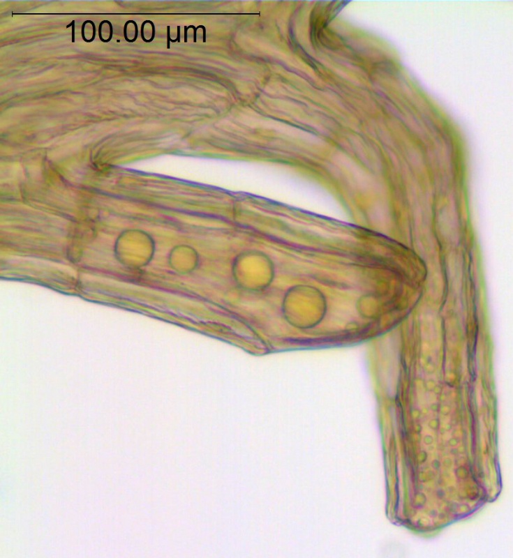 Cuscuta platyloba; Argentina, Burkart 10554 (CTES)