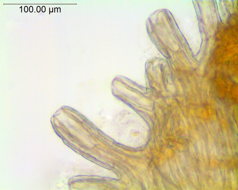 Cuscuta xanthochortos var. lanceolata; Paraguay, Hassler 5113 (NY, Type)
