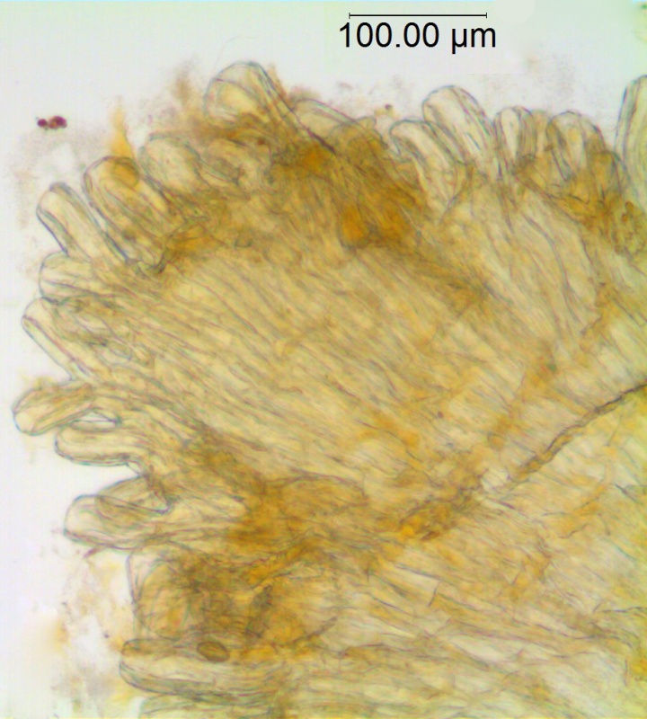 Cuscuta xanthochortos var. lanceolata; Paraguay, Hassler 5113 (NY, Type)
