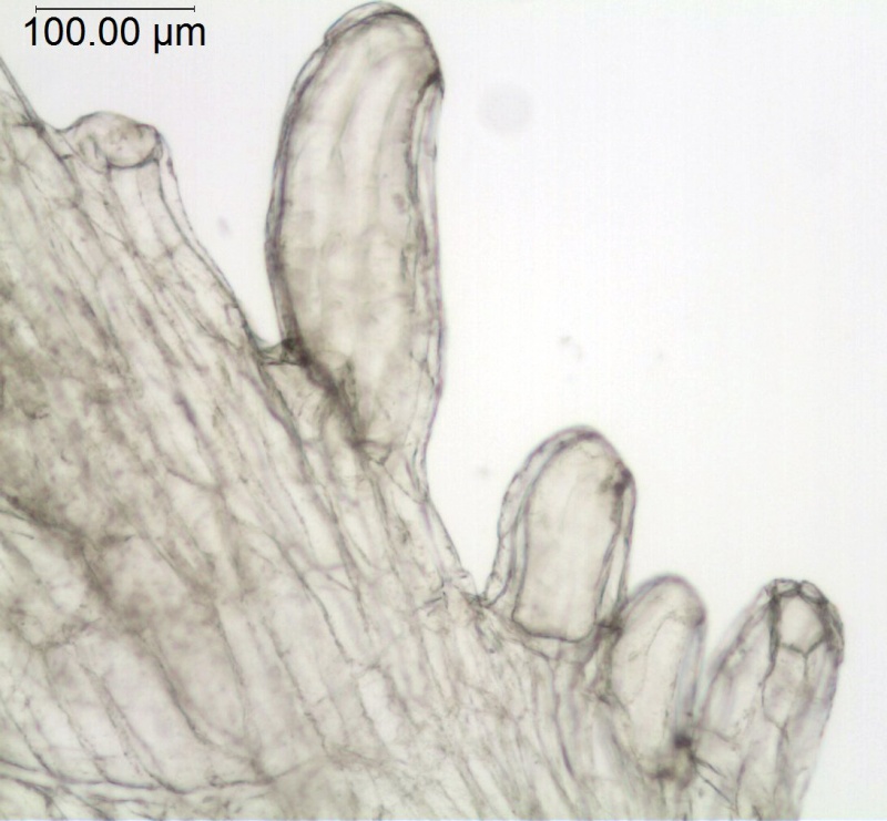 Cuscuta corymbosa var. grandiflora; Mexico, Pringle 11306 (NMS)