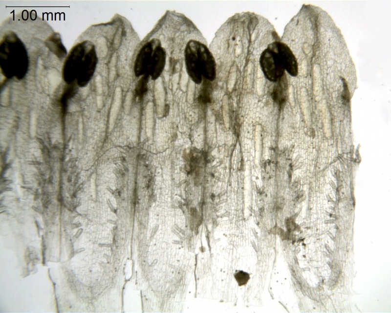 Cuscuta cozumeliensis; Guatemala, Kellerman 6580 (F)