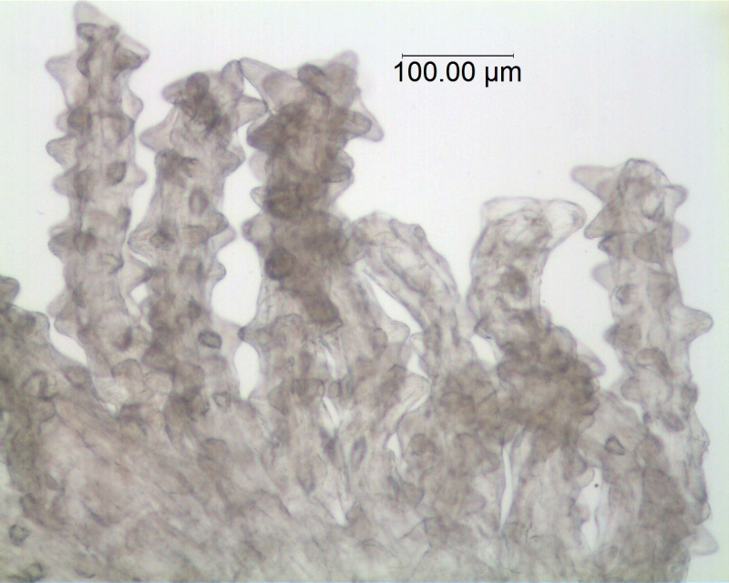 Cuscuta foetida var. pycnantha; Peru, Plowman et al. 14291 (F)