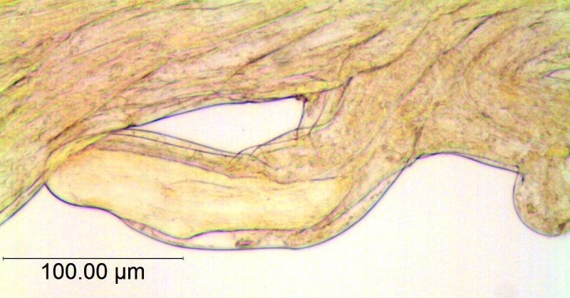 Cuscuta harperi; U.S.A., Alabama, Demaree 46295 (NY)