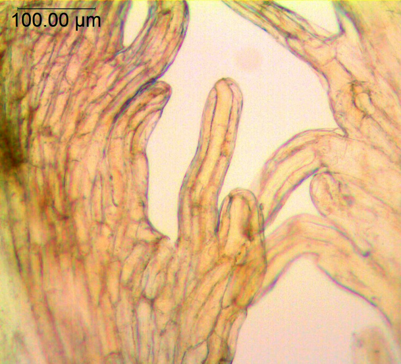 Cuscuta plattensis; U.S.A, Wyoming, Nelson 2741 (MO)