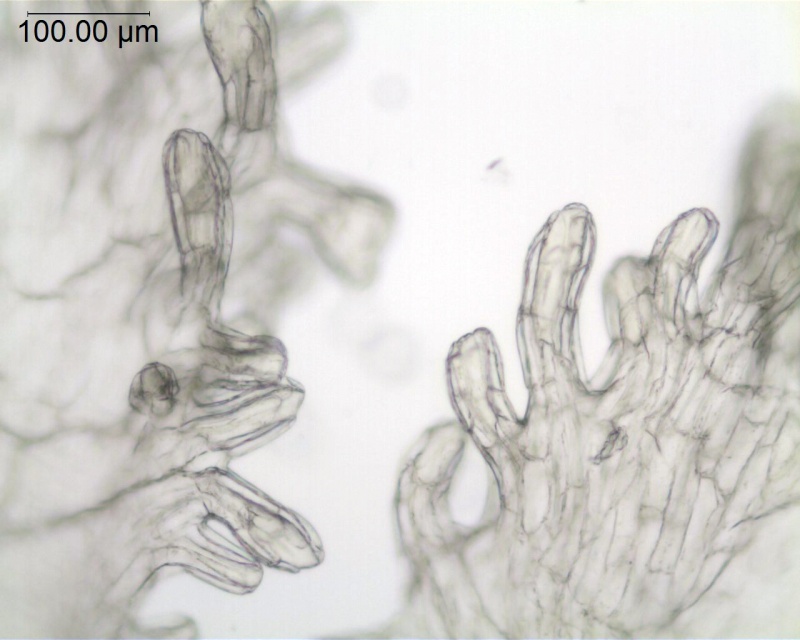 Cuscuta azteca (C. potosina var. globifera); Mexico, Pringle 11305 (F)