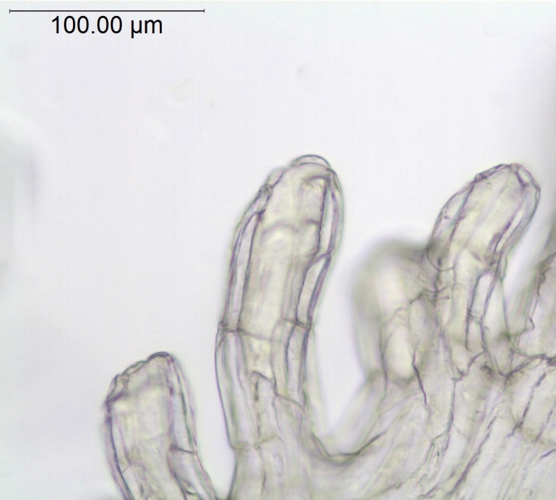 Cuscuta azteca (C. potosina var. globifera); Mexico, Pringle 11305 (F)