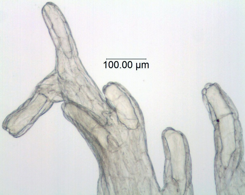 Cuscuta umbrosa; Canada, Alberta, Allen 150 (DAO)