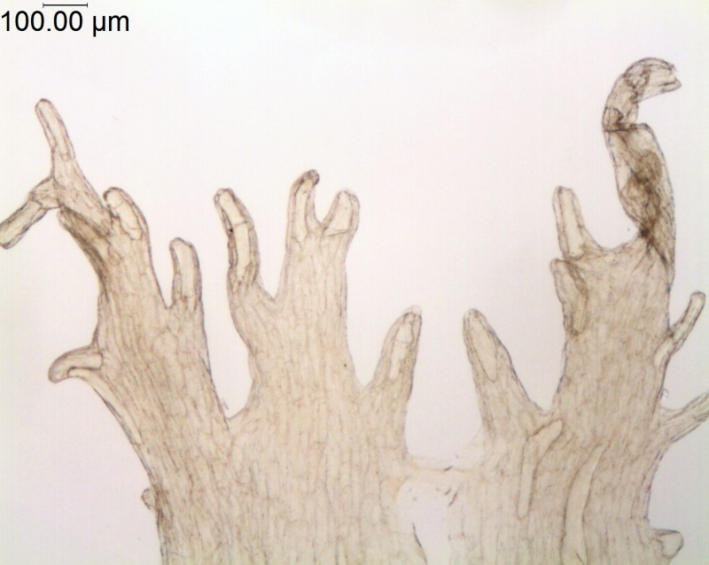Cuscuta umbrosa; Canada, Alberta, Allen 150 (DAO)
