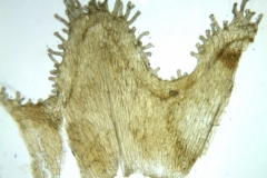 Cuscuta killimanjari; Malawi, Lacroix 4559 (MO)