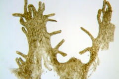 Cuscuta cephalanthi; U.S.A, Illinois, McDonald s.n. (NMS)