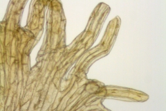 Cuscuta cephalanthi; U.S.A, Illinois, McDonald s.n. (NMS)