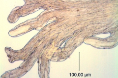 Cuscuta harperi; U.S.A., Alabama, Demaree 46295 (NY)