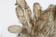 Cuscuta natalensis; South Africa, Rudatis 1319 (NBG)