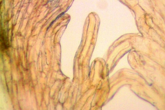 Cuscuta plattensis; U.S.A, Wyoming, Nelson 2741 (MO)