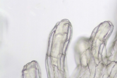 Cuscuta azteca (C. potosina var. globifera); Mexico, Pringle 11305 (F)