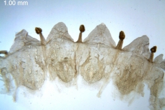 Cuscuta umbrosa; Canada, Alberta, Allen 150 (DAO)