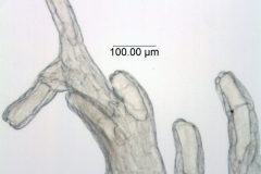 Cuscuta umbrosa; Canada, Alberta, Allen 150 (DAO)