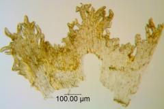 C. pauciflora; SebastiÃ¡n Teillier, Chile
