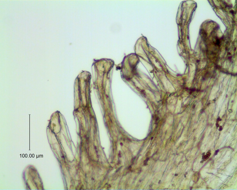 Cuscuta incurvata; infrastaminal scale detail (fimbriae with laticifers)