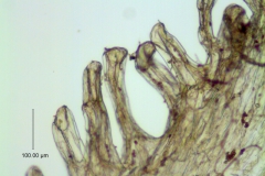 Cuscuta incurvata; infrastaminal scale detail (fimbriae with laticifers)