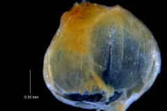 Cuscuta incurvata; capsule; note pericarp irregularly ruptured at the base