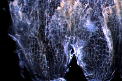 infrastaminal scale detail