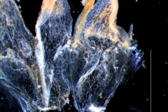 infrastaminal scales