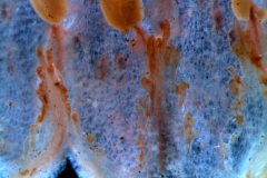 infrastaminal scales