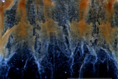infrastaminal scales