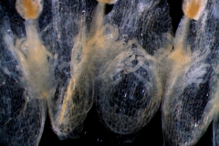 infrastaminal scales
