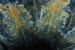 infrastaminal scales