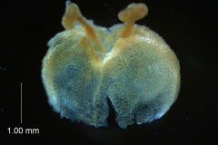 ovary, styles, stigma