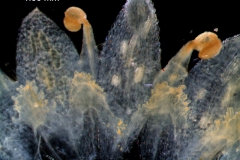 infrastaminal scales