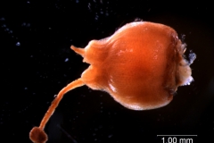 gynoecium