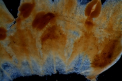 infrastaminal scales