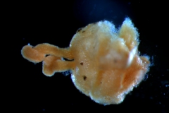 gynoecium