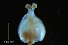 gynoecium