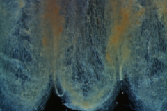 infrastaminal scales