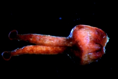 gynoecium