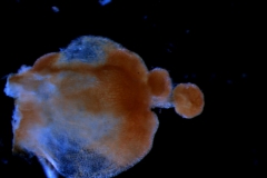 gynoecium