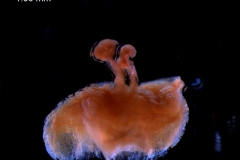 gynoecium