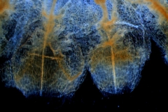 infrastaminal scales
