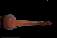 gynoecium