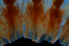infrastaminal scales