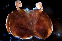 gynoecium