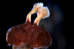 gynoecium